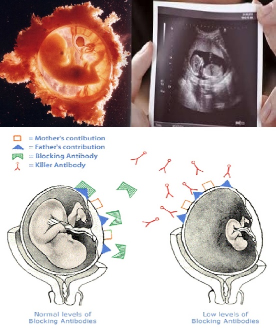 C:\Users\DR. Sherif\Desktop\corrected leaflets\الإجهاض\15 علاج الأسباب والمناعة.jpg