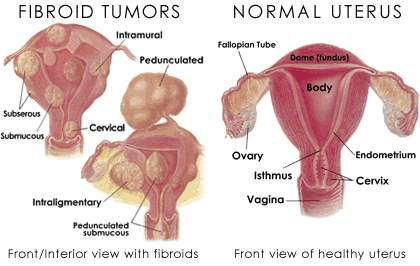 normal vs fibdoiy