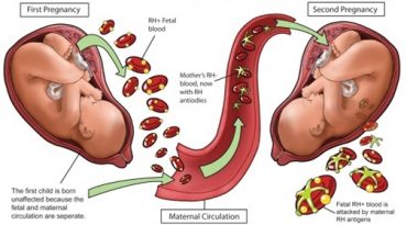 Effect of Maternal Blood Group on the Pregnancy Outcome